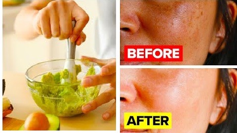 0 1 - 13 Homemade Face Masks For Glowing Youthful Skin